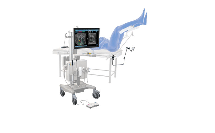 Cartographie De La Prostate Koelis Trinity Avf Biomedical