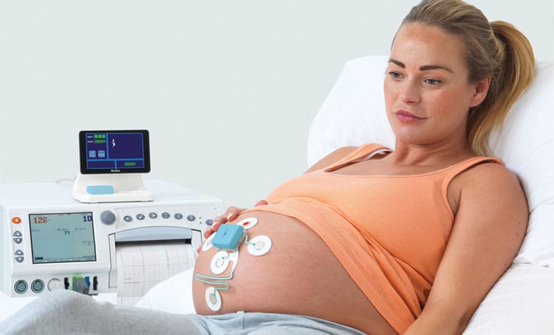 Choisir Matériel Monitorage Foetal